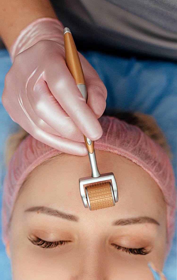 Dermaroller Sistema de Microneedling para piel radiante